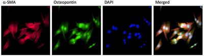 Ataxia telangiectasia mutated: The potential negative regulator in platelet-derived growth factor-BB promoted proliferation of pulmonary arterial smooth muscle cells